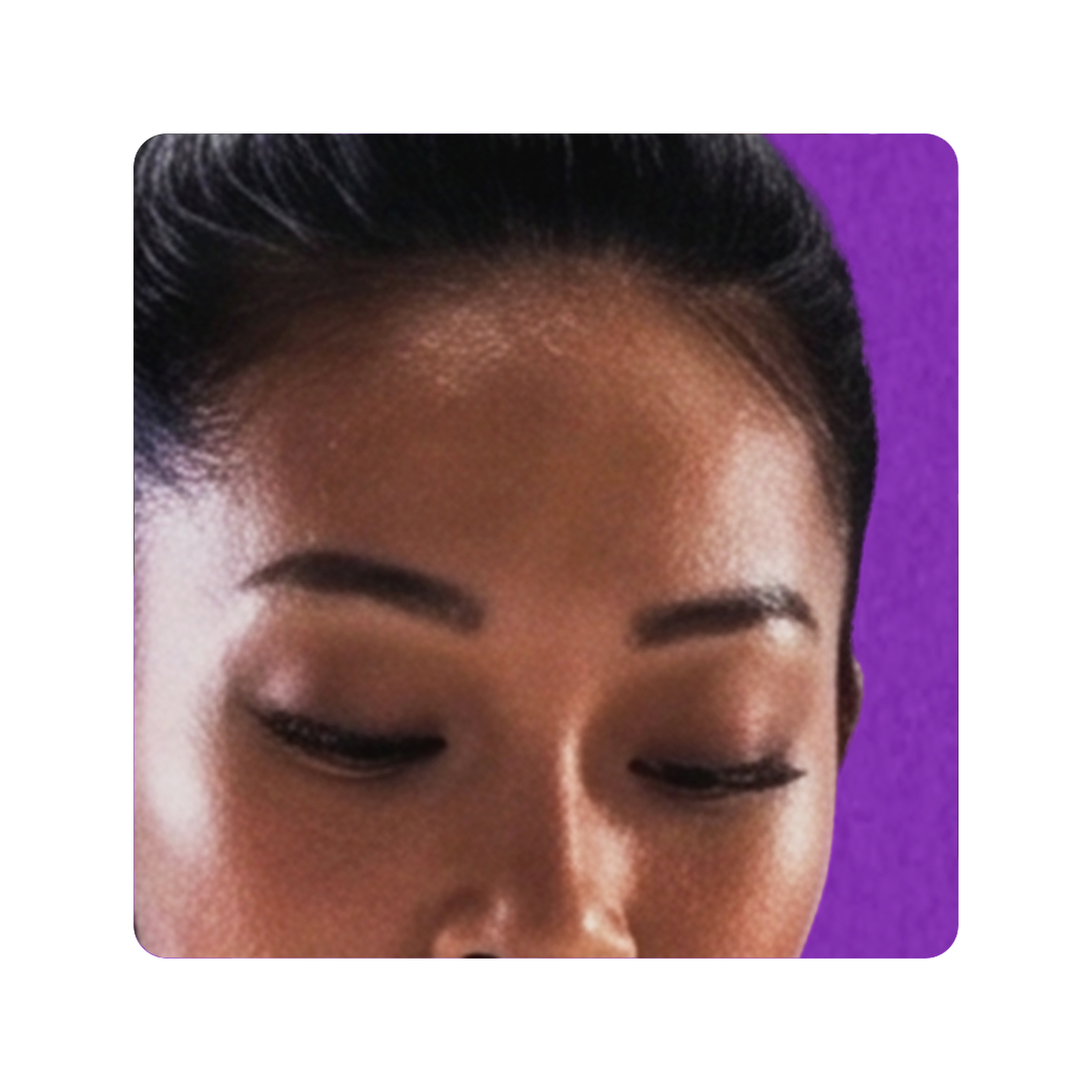 AFT Trial Forehead