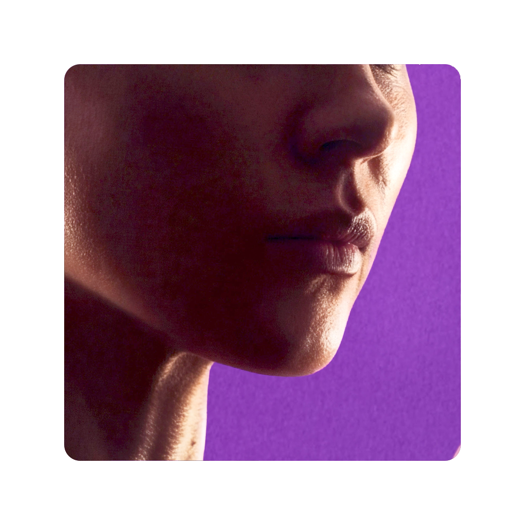 AFT Trial Upper Lip